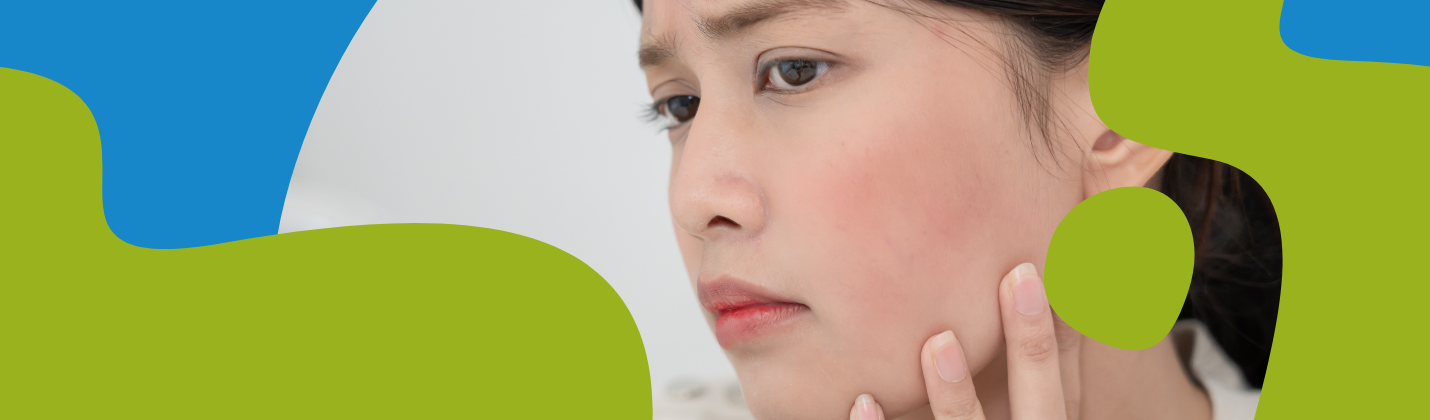 Couperose Skin Care: Creams, Supplements & Tips